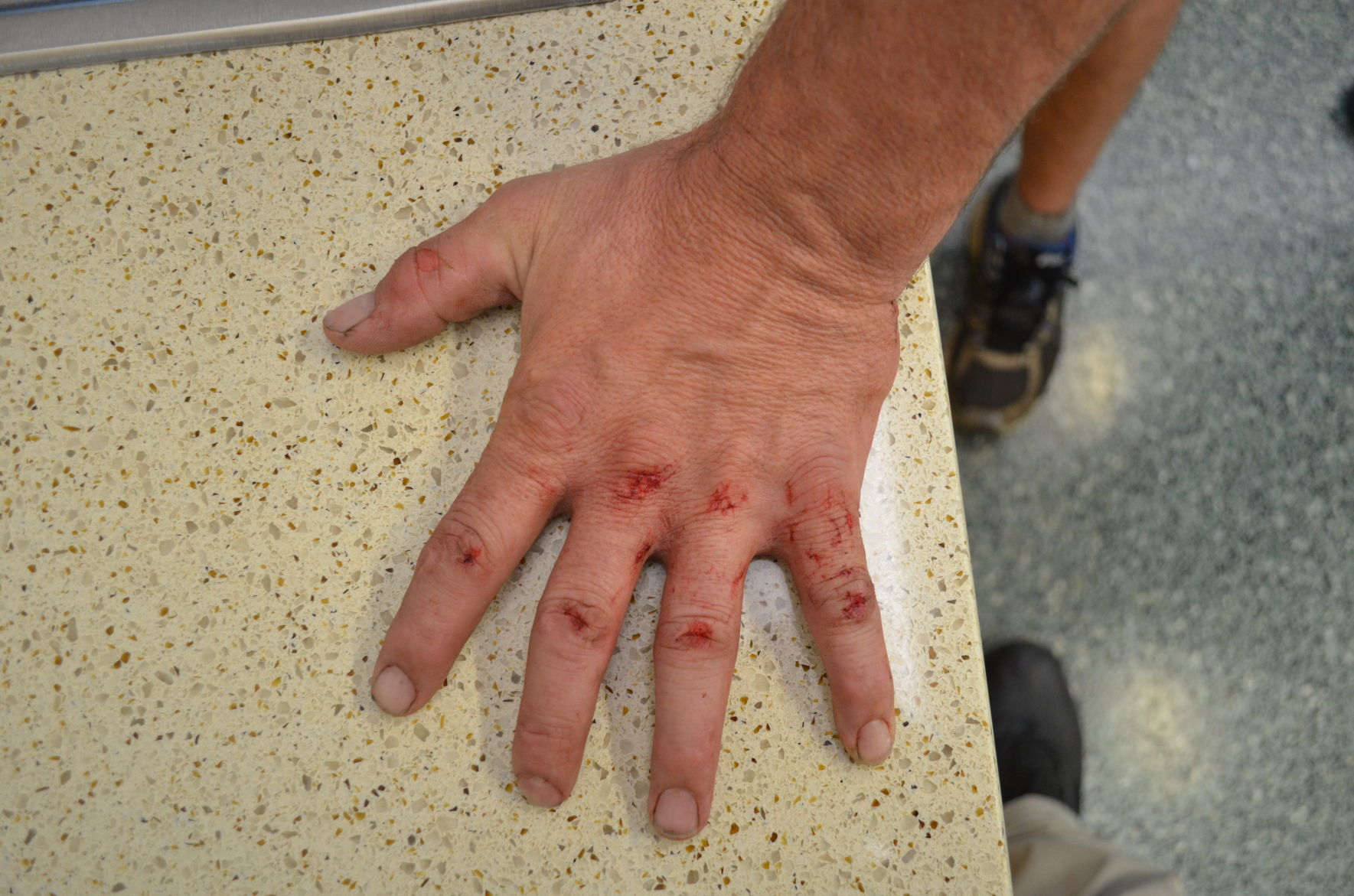 Todd Kendhammer's left hand